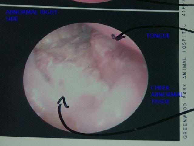 bronnysscoprerightabnormaltissuelab.jpg