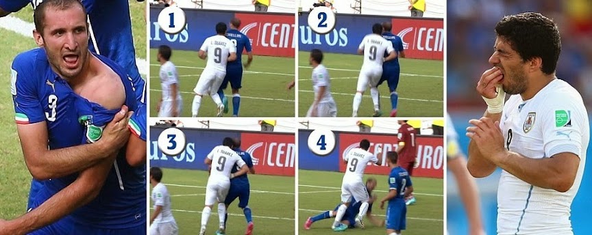 Luis+Suarez+bite+chiellini.jpg