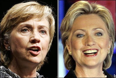 hillary%20before%20after%20botox%20video.jpg