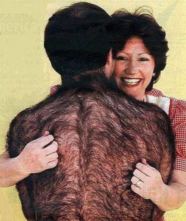 Caption-This-Hairy-Back.jpg