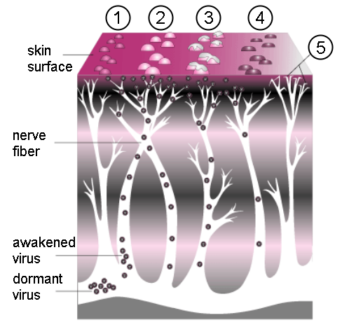 A_Course_of_Shingles_diagram.png