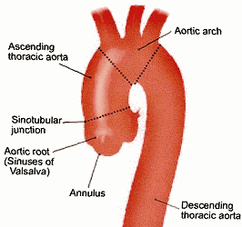 normal_aorta.gif
