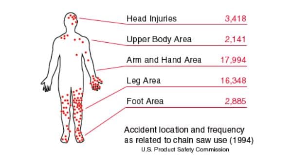 chainsaw-injury-statistics.jpg