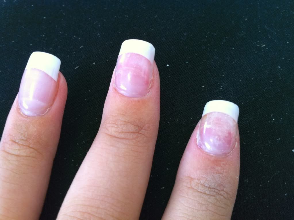 Can I still get acrylic nails done even if my nail is lifted from my nail  bed? - Quora