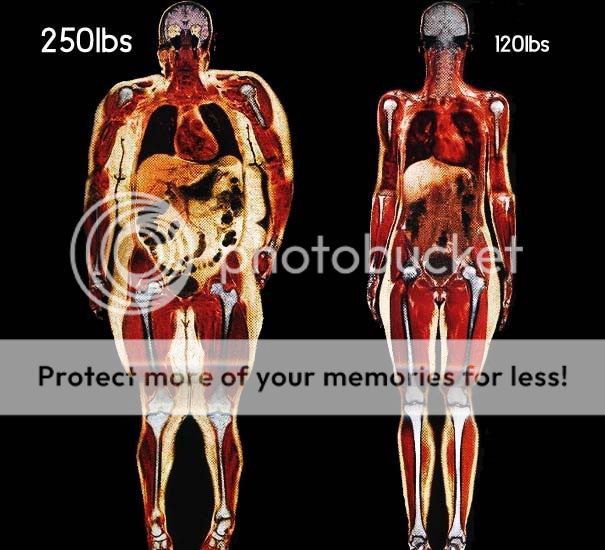 pictureoftheday0007-bodyscans-250-v.jpg