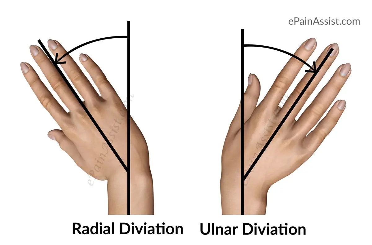 Radial-Deviation.jpg
