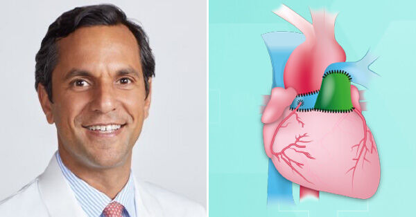 www.heart-valve-surgery.com