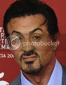 Sylvester-Stallone-plastic-surgery_zps4dbcabb6.jpg