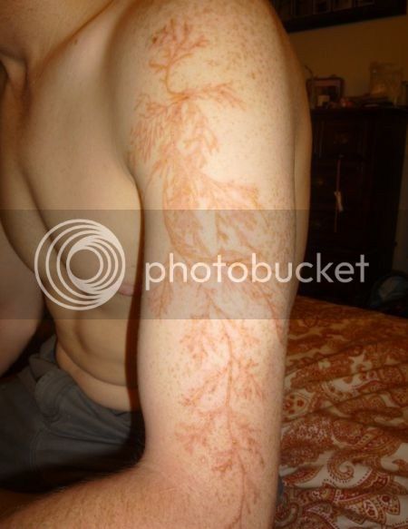 funny-tattoos-getting-struck-by-lightning-natures-way-of-giving-you-a-tattoo.jpg