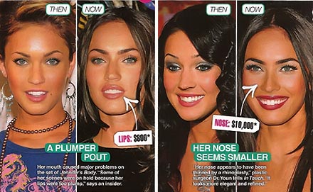 megan-fox-plastic-surgery.jpg