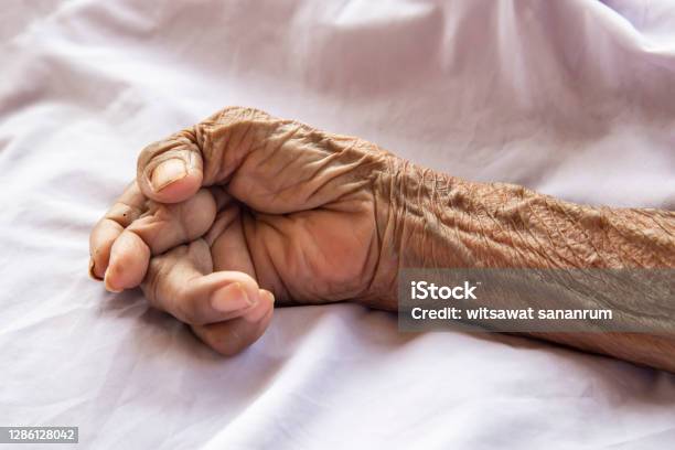 the-hands-of-an-old-woman-with-rheumatoid-arthritis-diseases-caused-picture-id1286128042