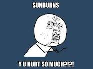 sunburn.jpg