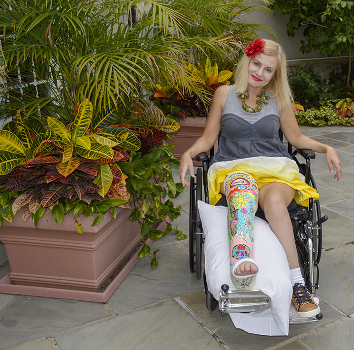 wheelchair-woman-legcast.jpg