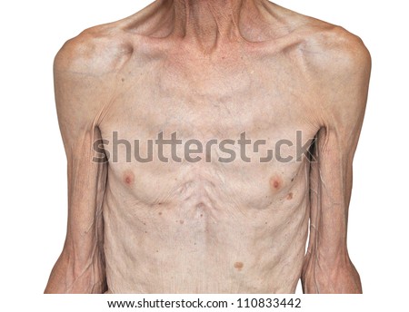 stock-photo-skinny-male-torso-isolated-on-white-background-110833442.jpg