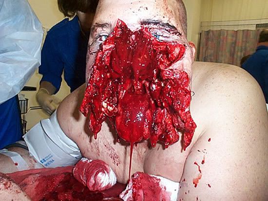 motorcycle-accident-gross.jpg