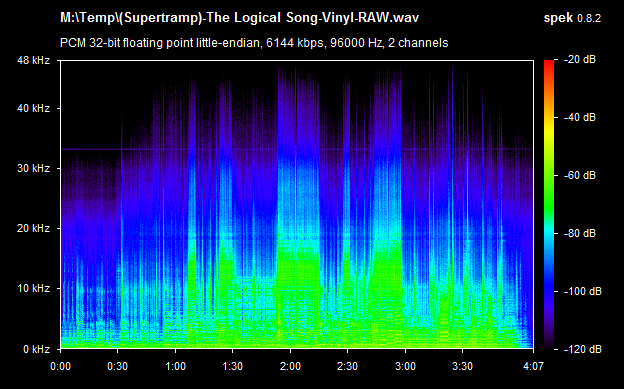 (Supertramp)-The Logical Song-Vinyl-RAW.wav.png