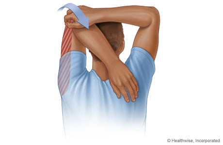 tricep-stretches.jpg
