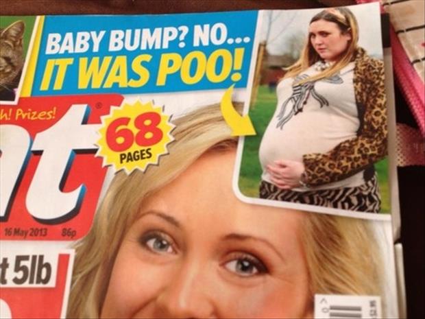 woman-thought-she-was-pregnant-but-it-was-really-backed-up-poop.jpg