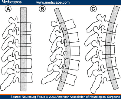 nf448307.fig6.gif