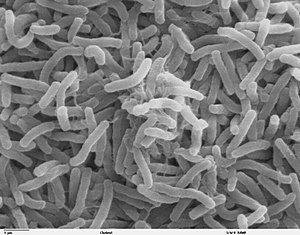 300px-Cholera_bacteria_SEM.jpg